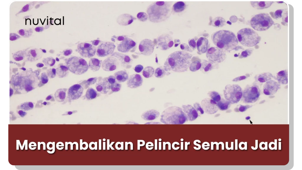 Synovil merangsang penghasilan cecair sinovial untuk sendi
