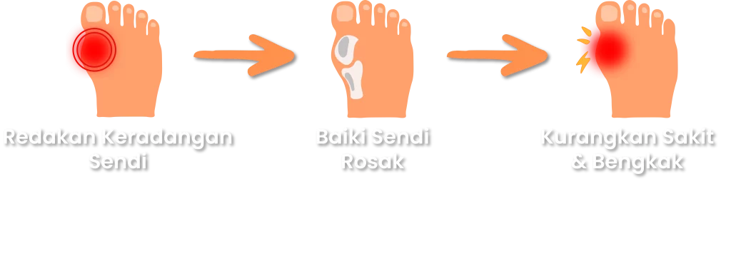 Synovil: Redakan keradangan sendi, baiki sendi rosak dan kurangkan sakit serta bengkak