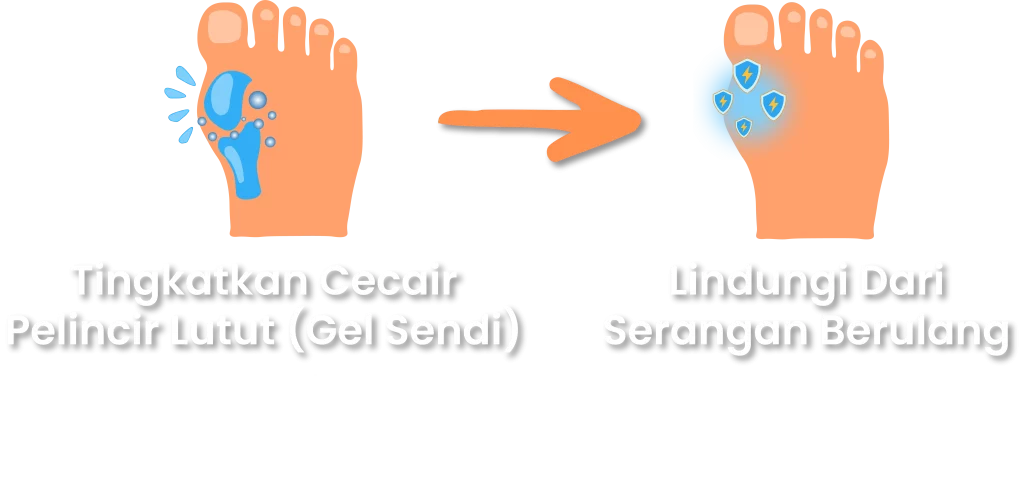 Synovil tingkatkan gel sendi dan lindungi dari serangan gout berulang