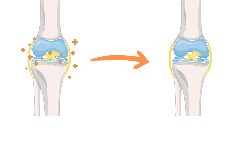 Synovil bantu baiki struktur sendi dan kuatkan sokongan otot